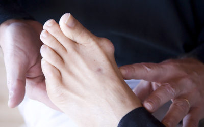Bunion Surgery