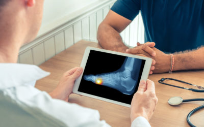 Everything You Need to Know About Rheumatoid Arthritis (and How This Condition Can Affect Your Feet)