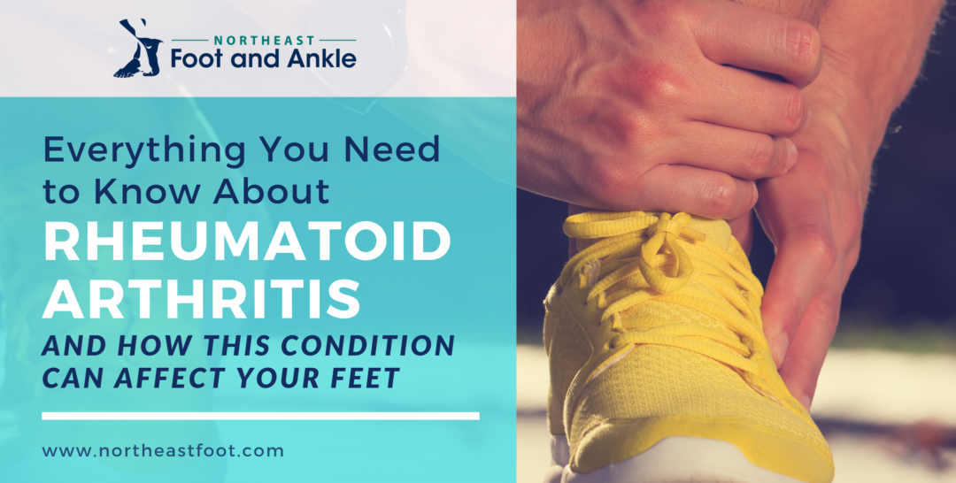Everything to Know About Rheumatoid Arthritis NE Foot & Ankle