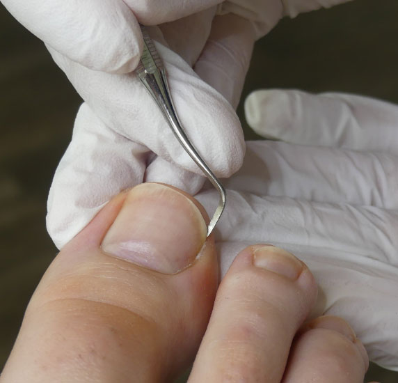 Skin-and-Nail-condition-image child sport inury