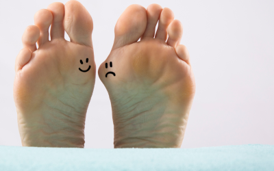 Let’s Talk About Bunion Correction Surgery