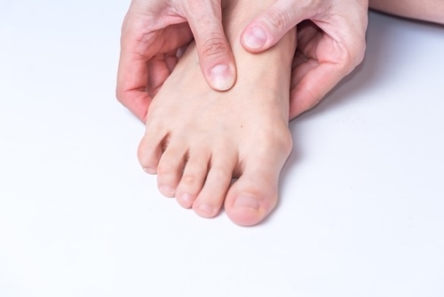 Bunions