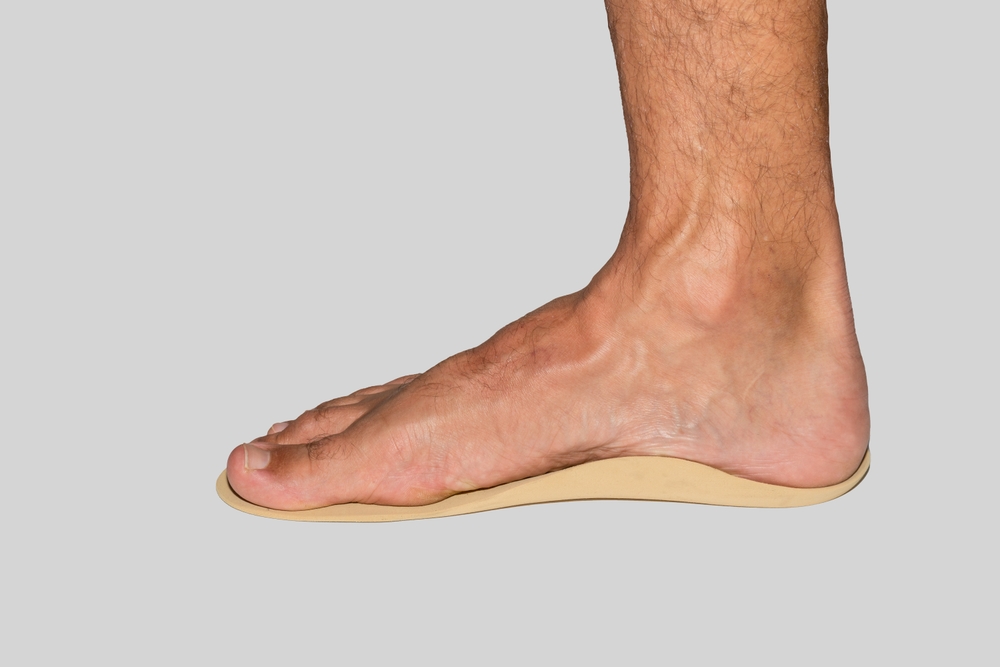Flat Feet Support