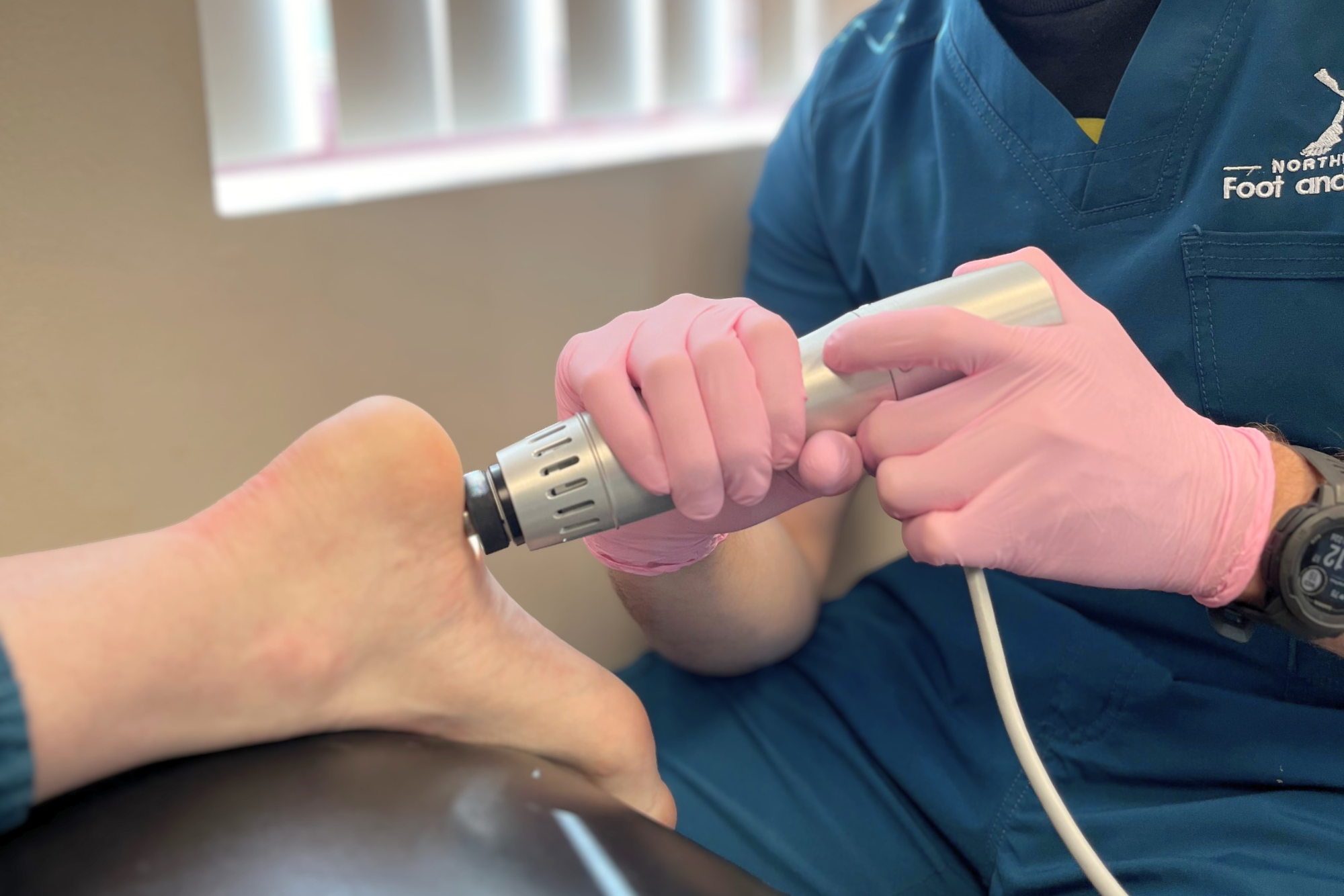 Shockwave Treatment for Plantar Fasciitis