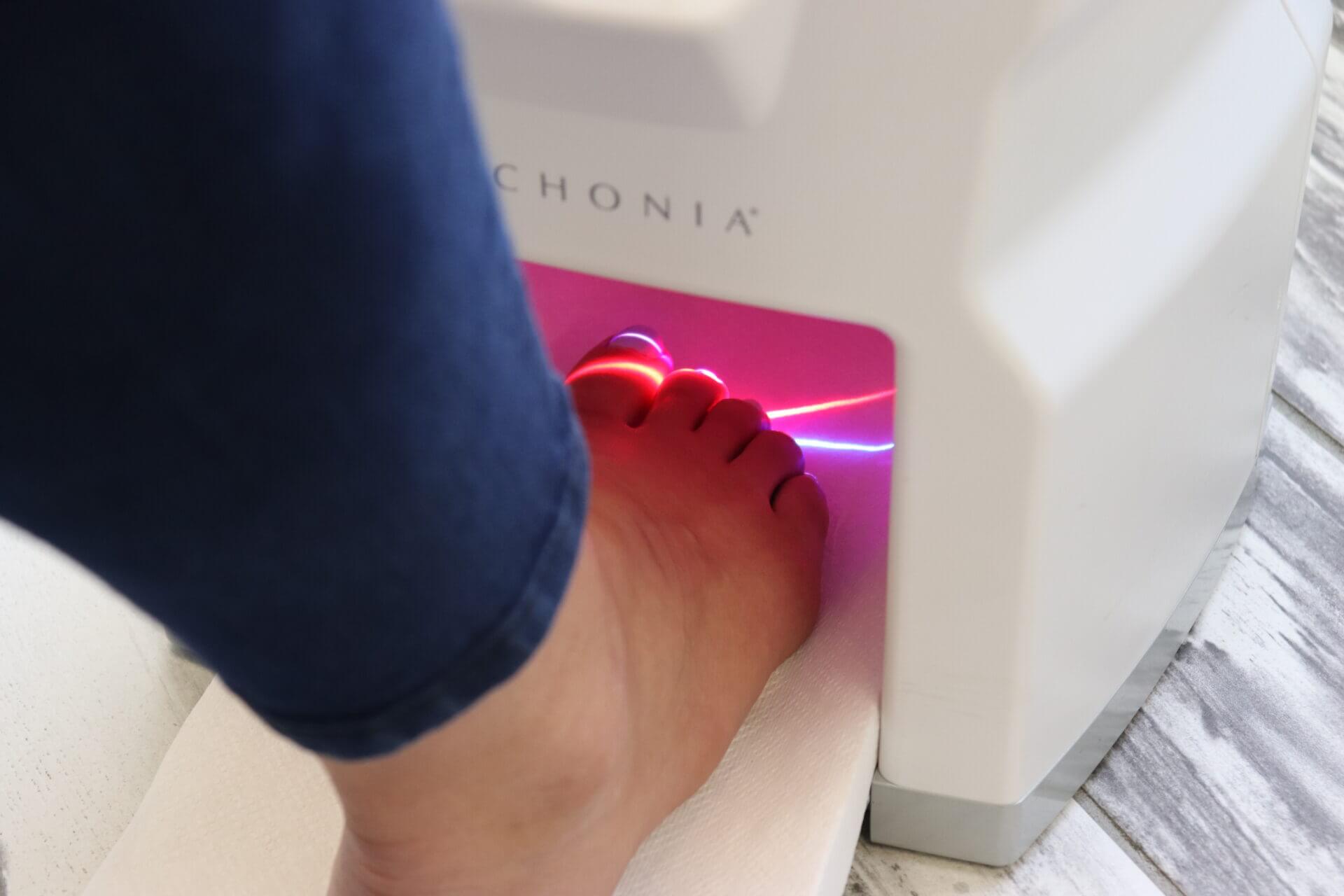 lunula laser therapy